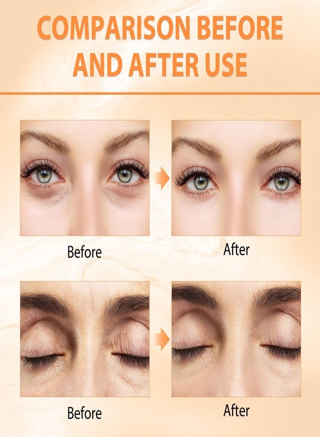 REATIFUL 2PCS Revive Glow Vitamin C Eye Balm, Vc Anti-Wrinkle Eye Serum Oil,Reducing Dark Circle,Hydrating Eye Cream,Improve Dark Circles,Reduces Puffiness (2pcs) - Image 4